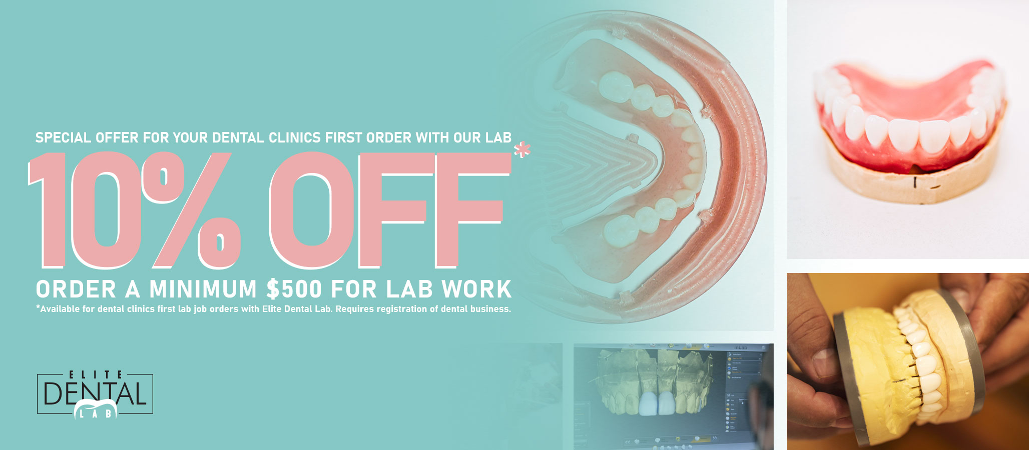 Special Offer for Dental Clinics first lab work orders with Elite Dental Lab